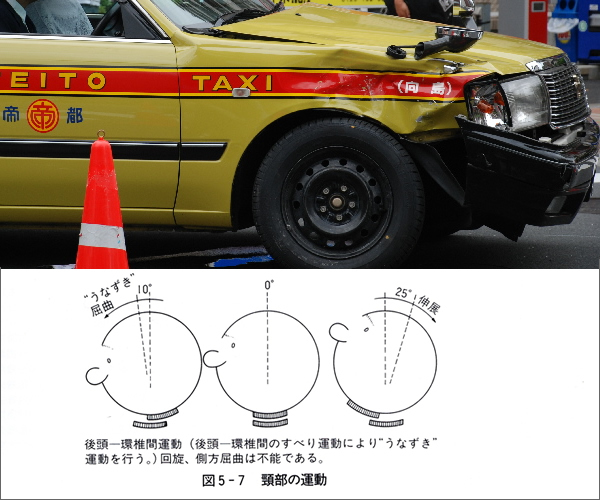 交通事故鑑定【事例集】事故鑑定、事故現場の検証解析調査